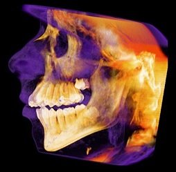3d-cbct
